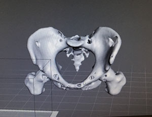 Computer generated 3D image of the pelvis